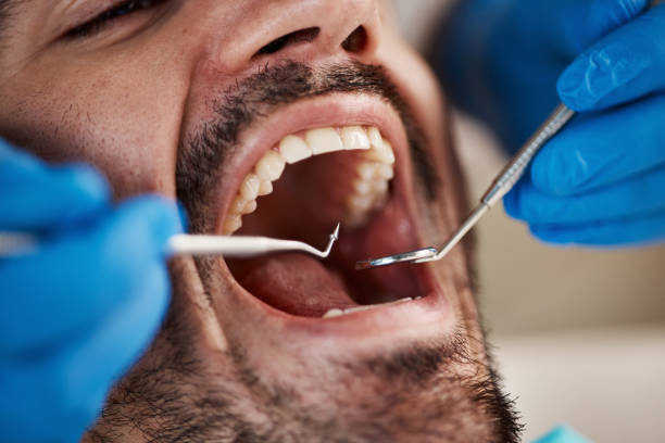 Best Emergency Denture Repair in Delphi, IN