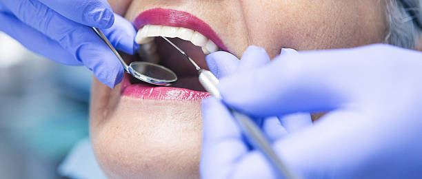 Best Emergency Root Canal Treatment in Delphi, IN